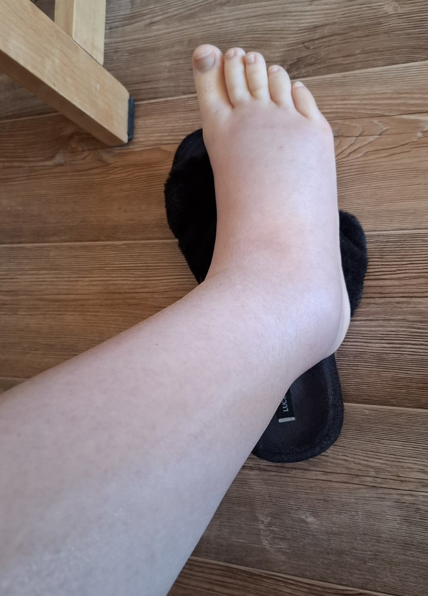 Ноги стали синющные и какие-то шершавые