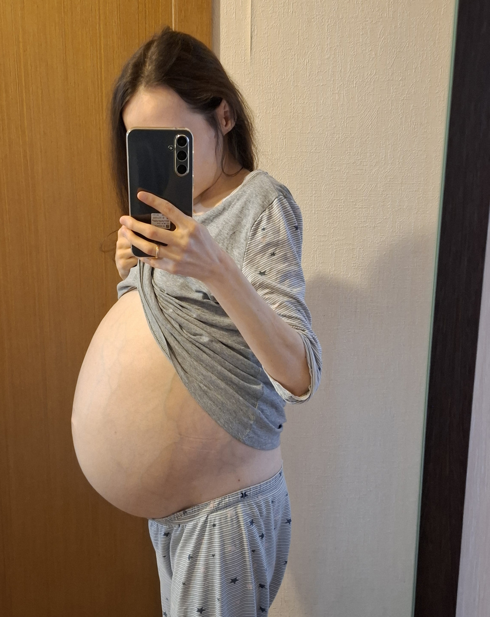 Напряженный асцит при опухоли яичников