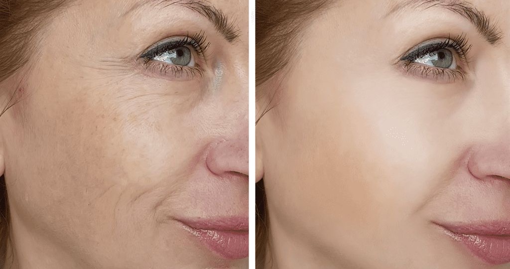 ШОК! Смазала лицо рыбьим жиром – эффект просто космос 🌟