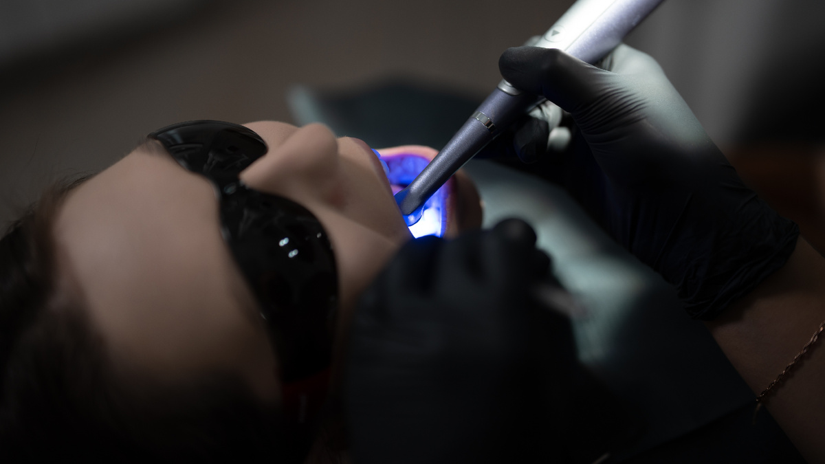 Как часто нужно менять резинки, которые держат дугу на брекетах