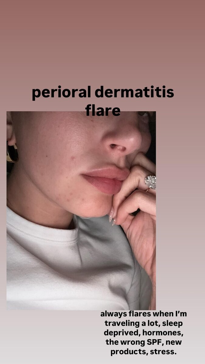    Фото: Инстаграм (запрещён в РФ) @haileybieber