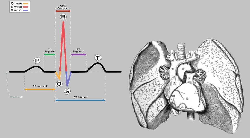   Agateller / Wikimedia Commons / Public Domain