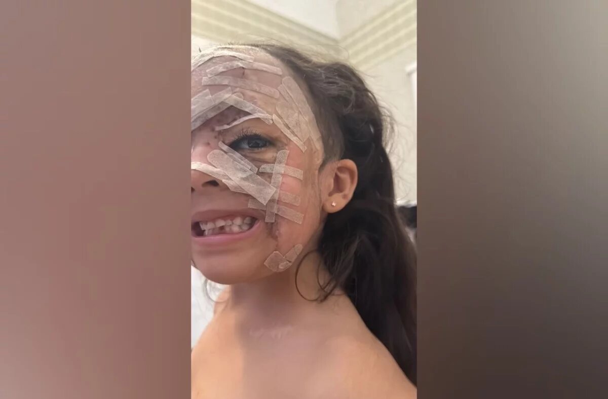    Феннеры рассказали, что Луна попросила в подарок после операции