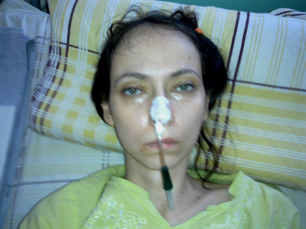 Через 2 недели после той уникальной операции, листайте