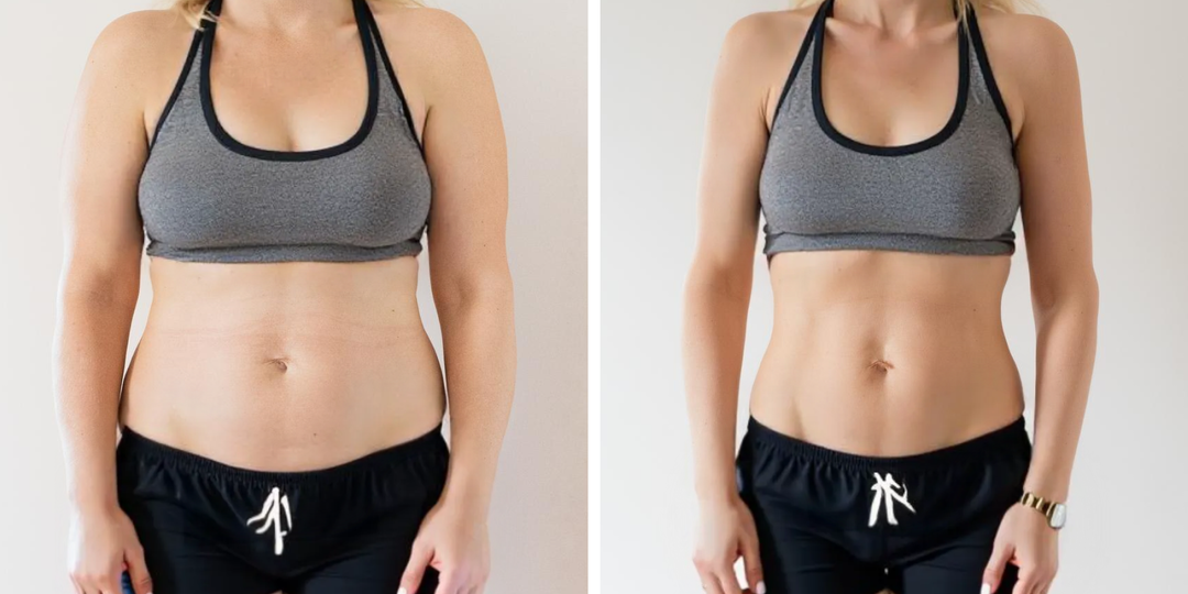 Убрала отеки за 7 дней - упражнения, от которых объемы уходят на глазах