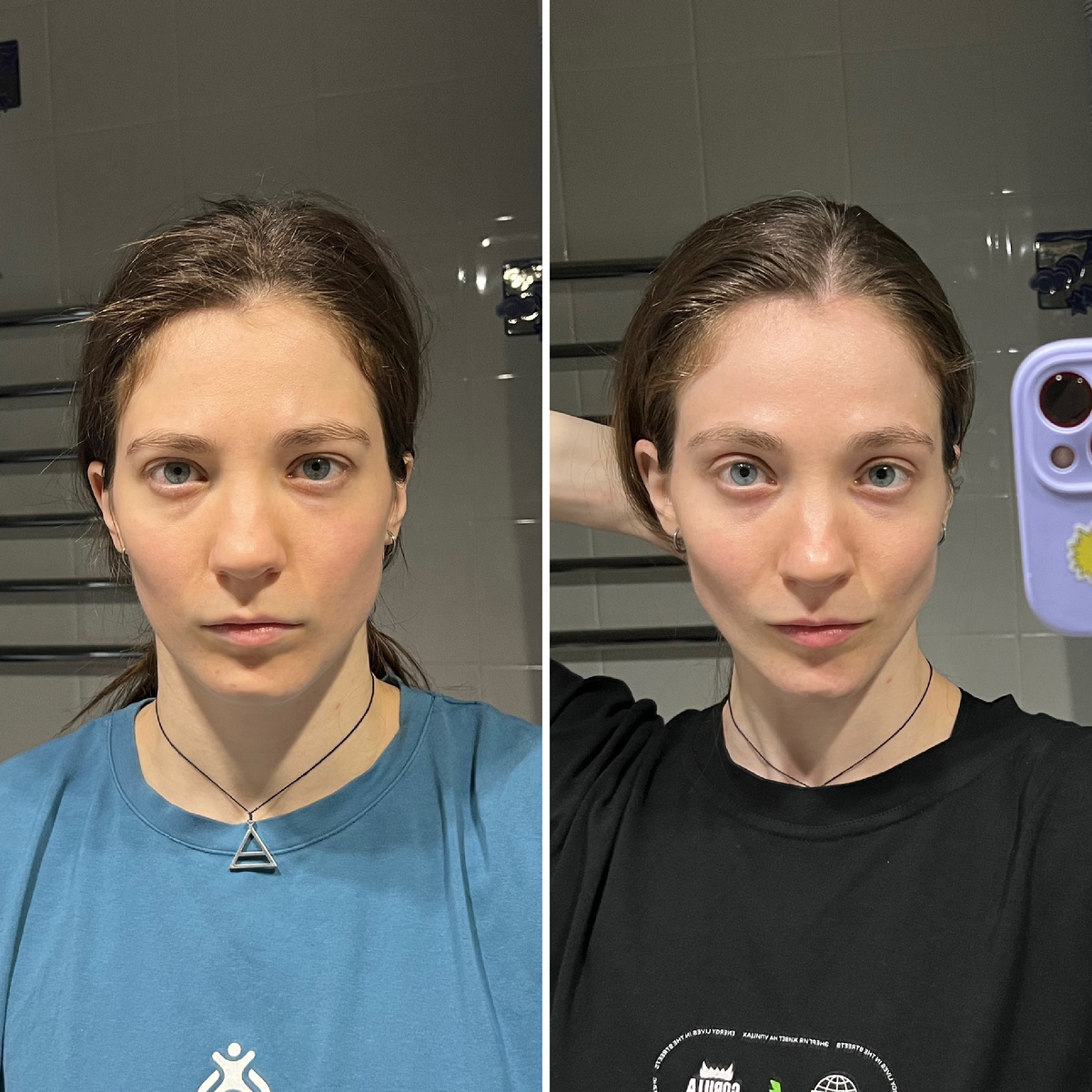 моё лицо без тренировок, и с 😅