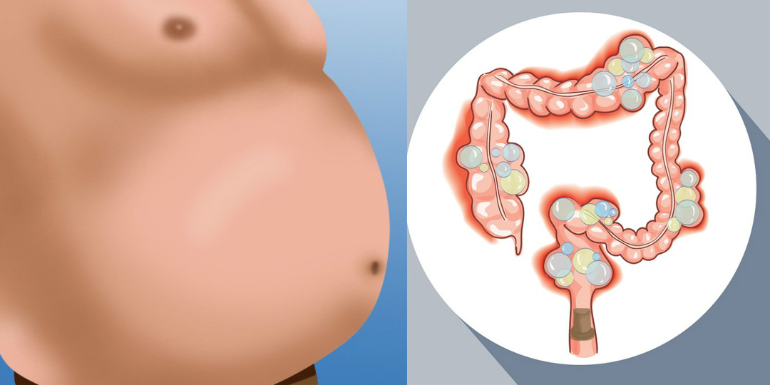 Что значит вздутие живота вечером — о чём сигналит кишечник