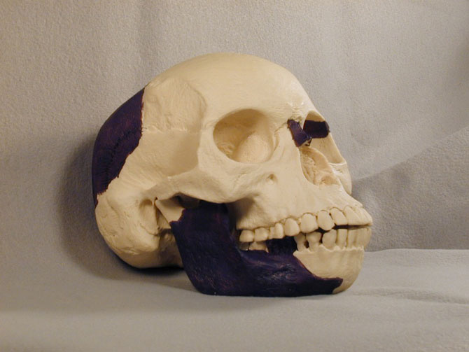 Череп пилтдаунского человека