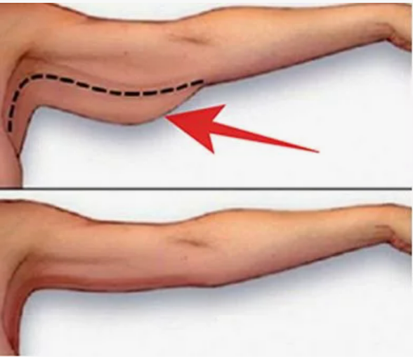 Как избавиться от обвисших рук при помощи упражнений