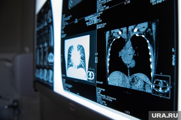 При осложнениях врач может назначит рентген поврежденной части тела
Фото: Анна Майорова © URA.RU