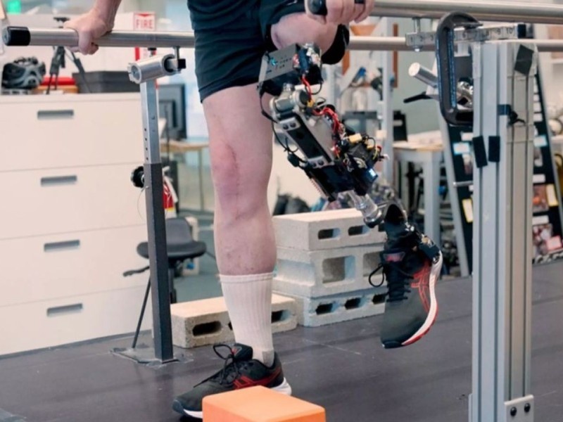    Новое бионическое колено ощущается как часть тела [ВИДЕО]