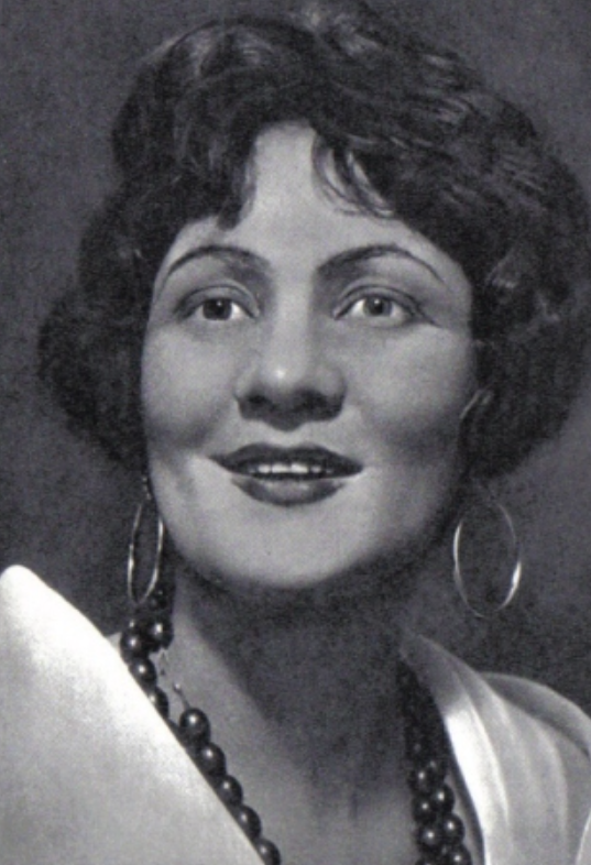 У Ольги Пыжовой была гетерохромия. Один глаз - карий, другой - зелёный