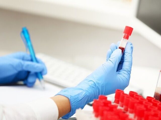    Фото: 123RF/serezniy