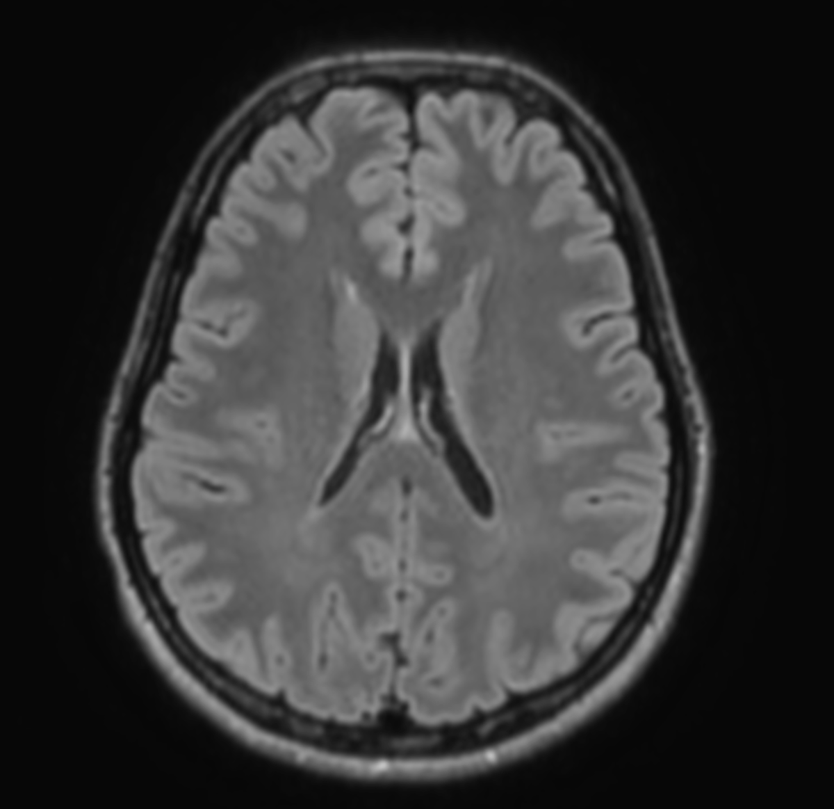 Вот как рентгенолог представляет себе человека со здоровым головным мозгом