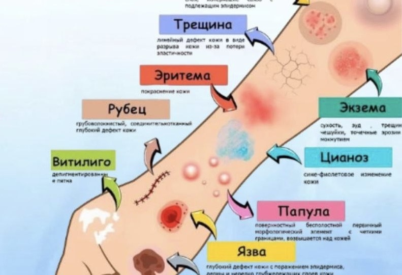 Что творится с кожей? 12 сигналов организма, которые нельзя игнорировать