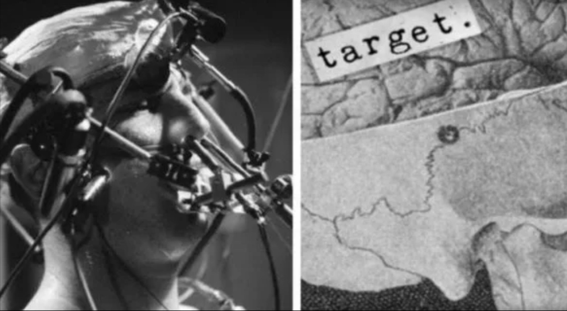 Эксперименты с ЛСД: мрачная правда. Фото взято из общедоступных источников.