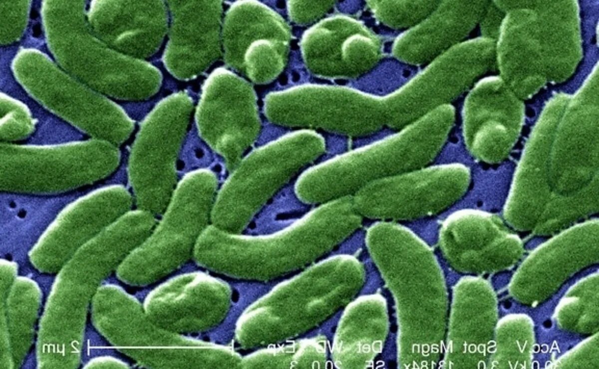    О неграмотных страшилках и ужасной бактерии Vibrio в Турции, вызывающей холеру