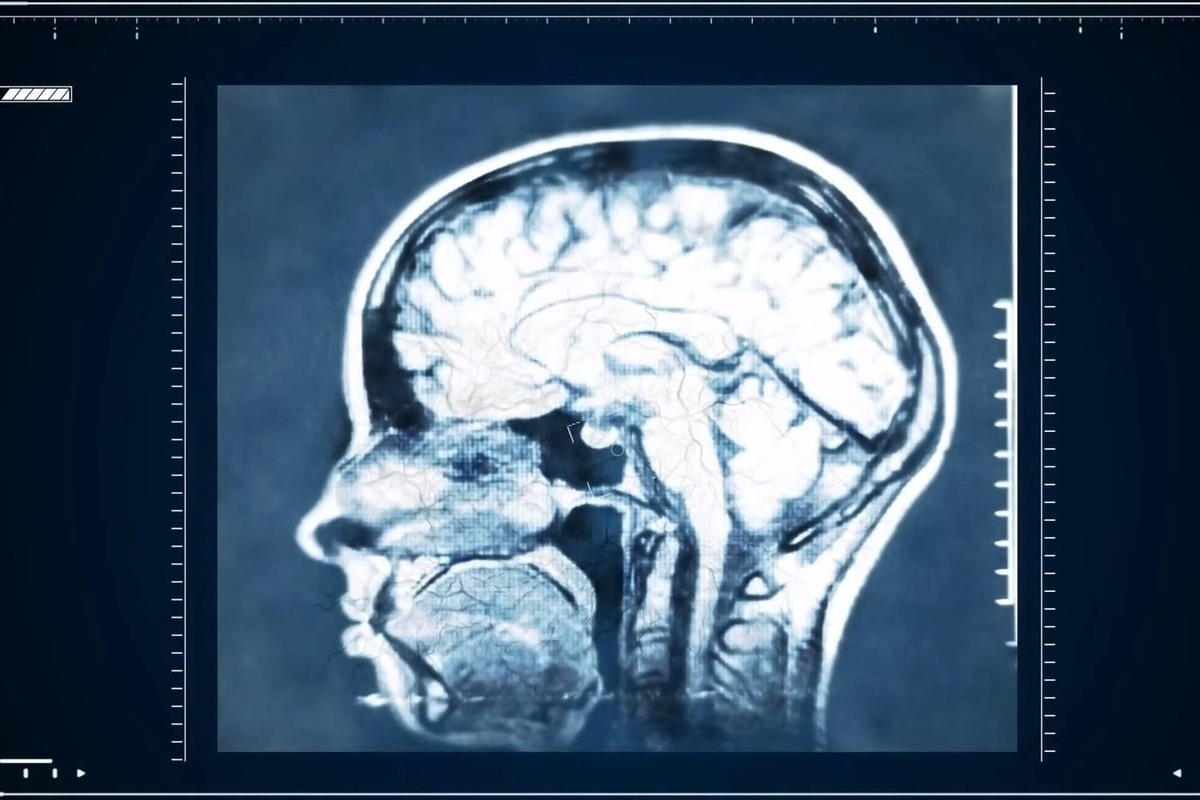   скриншот из видео «Невероятная наука 2. 5 Серия. "Неизвестный мозг". Документальное Кино» с канала «Star Media»