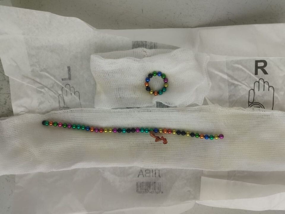    Барнаульские врачи извлекли из ребенка больше 50 магнитных шариков. Источник: Детская городская клиническая больница №7