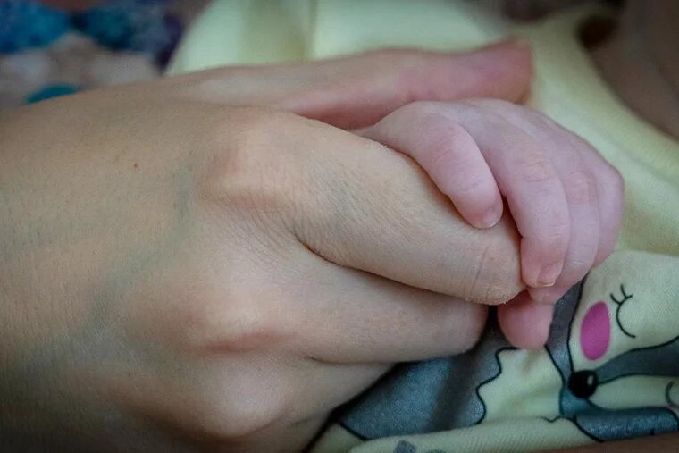 В Свердловской области родился мальчик с необычной внешностью. Фото