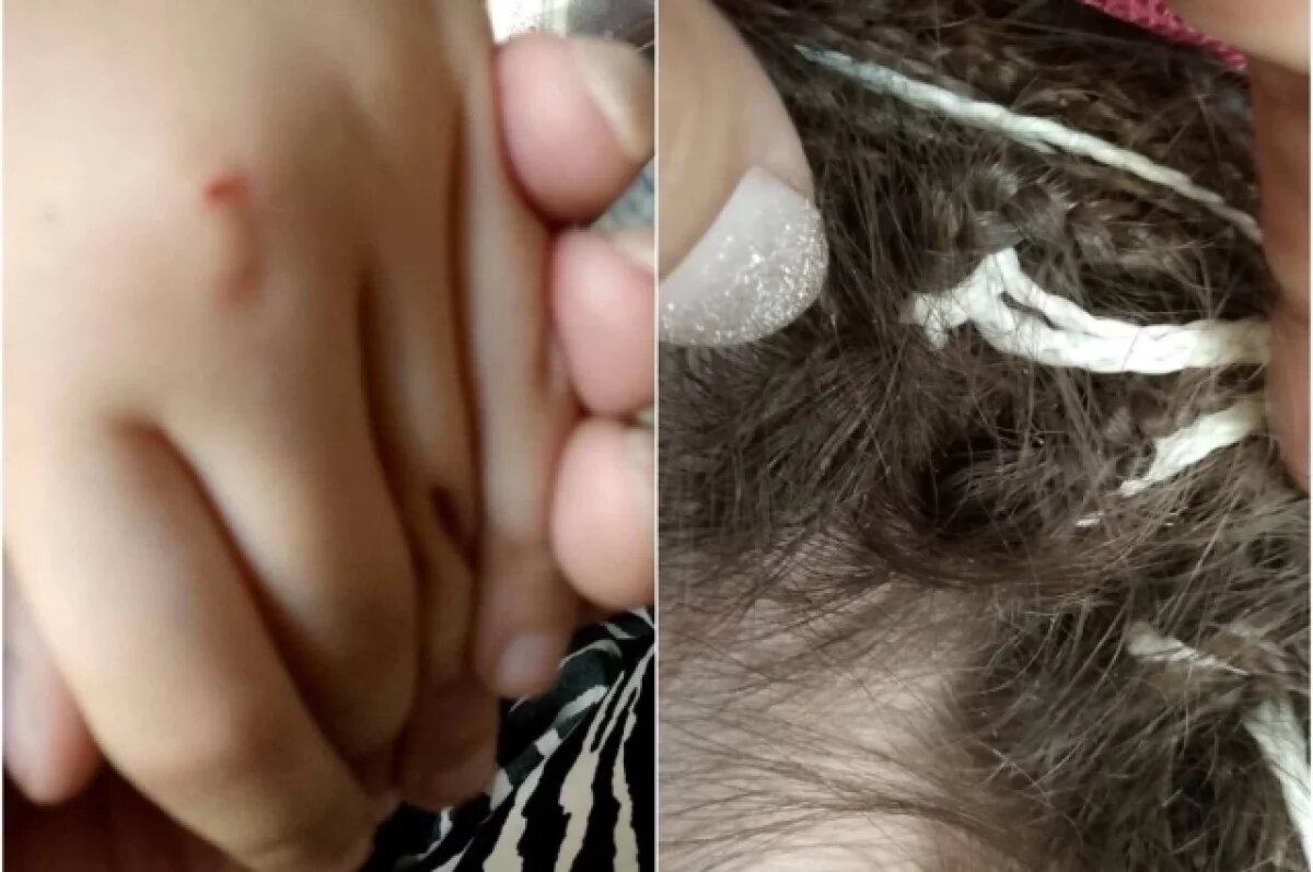    Под Новосибирском школьница избила сверстницу до сотрясения мозга