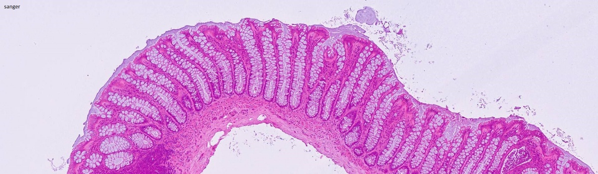 срез тонкого кишечника