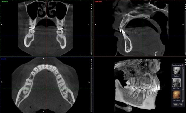 3D компьютерная томография 