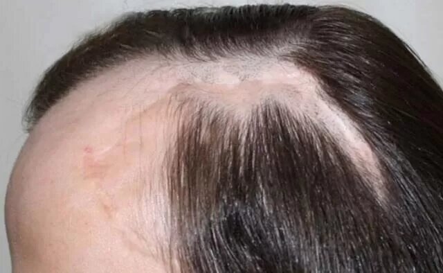 Хитрости: Делай ЭТО, чтобы сохранить волосы летом