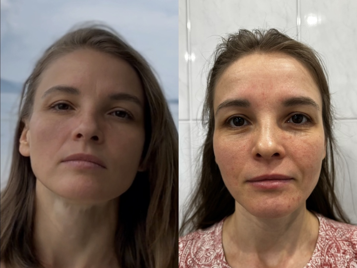 Вот такой эффект через 2,5 месяца. Сама не ожидала