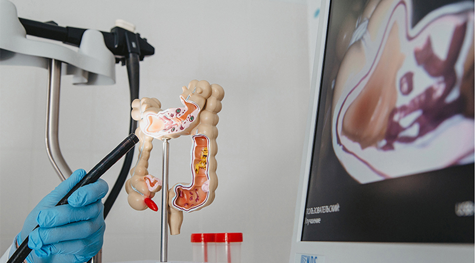 Колоноскопия — когда пора перестать откладывать, зачем и кому это действительно важно