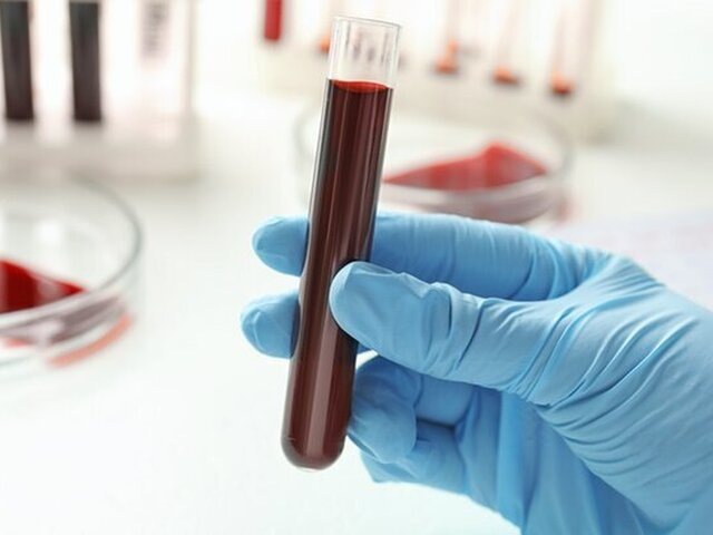    Фото: 123RF/liudmilachernetska