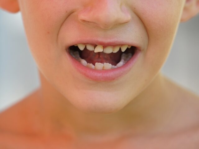    Фото: visibile/123RF