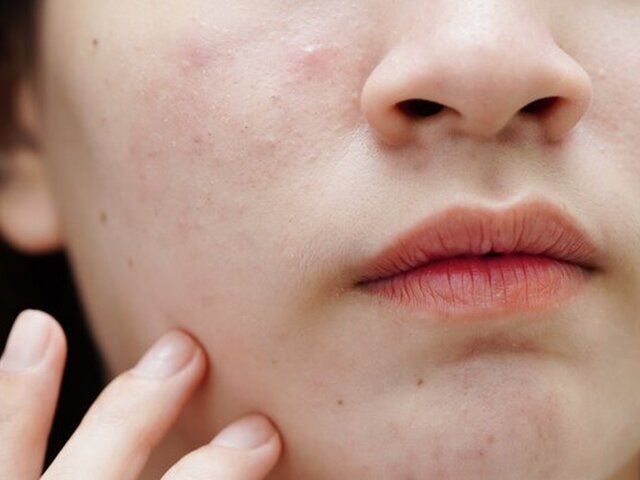    Фото: 123RF/sweettomato