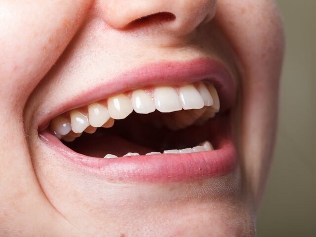    Фото: homonstock/123RF