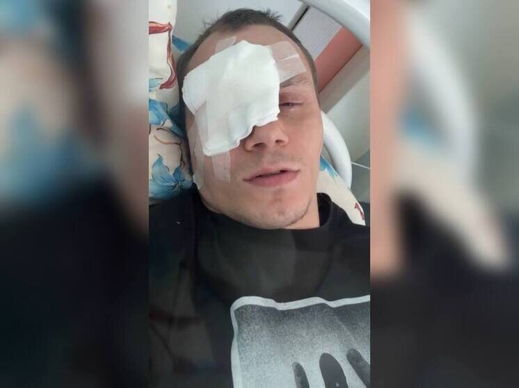     По словам блогера, глаз сильно болит, но самое страшное он уже пережил. Фото: соцсети Корнея Тарасова.