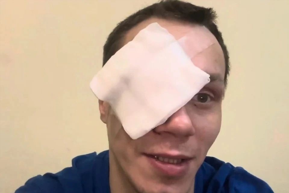    Блогер Корней Тарасов полностью лишился глаза после драки с девушкой: подробности. Фото: Фото: YouTube-канал Корнея Тарасова