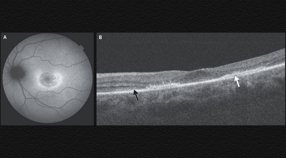   Aaron Donnelly, Noel Horgan / NEJM, 2025