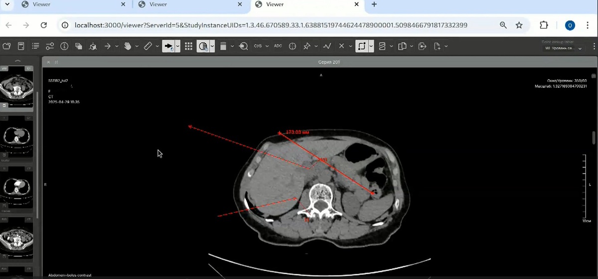 Просмотр изображения в 2D-режиме. Аннотирование и измерение. 