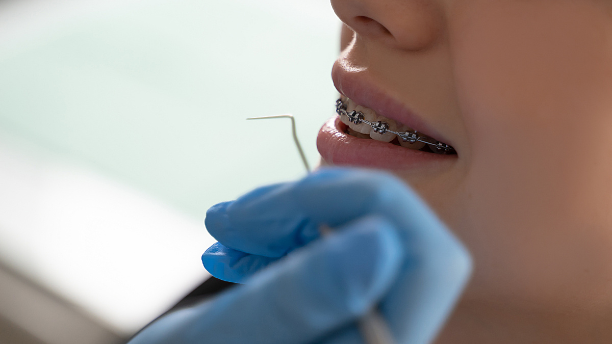 Как прикус влияет на речь