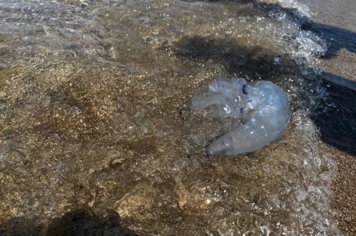    Кубанский врач объяснила, как оказать первую помощь при ожоге от медузы