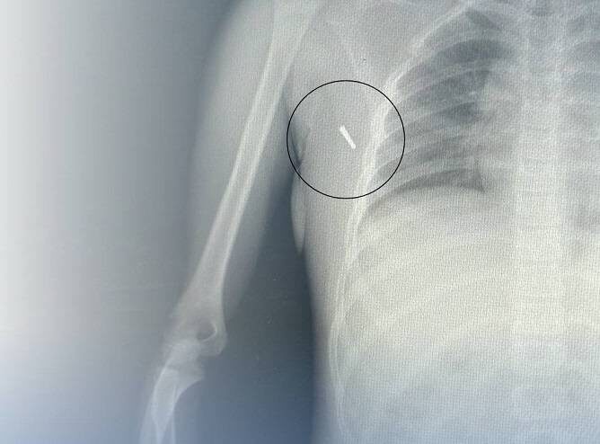    Источник фото: Артемовская городская больница №1