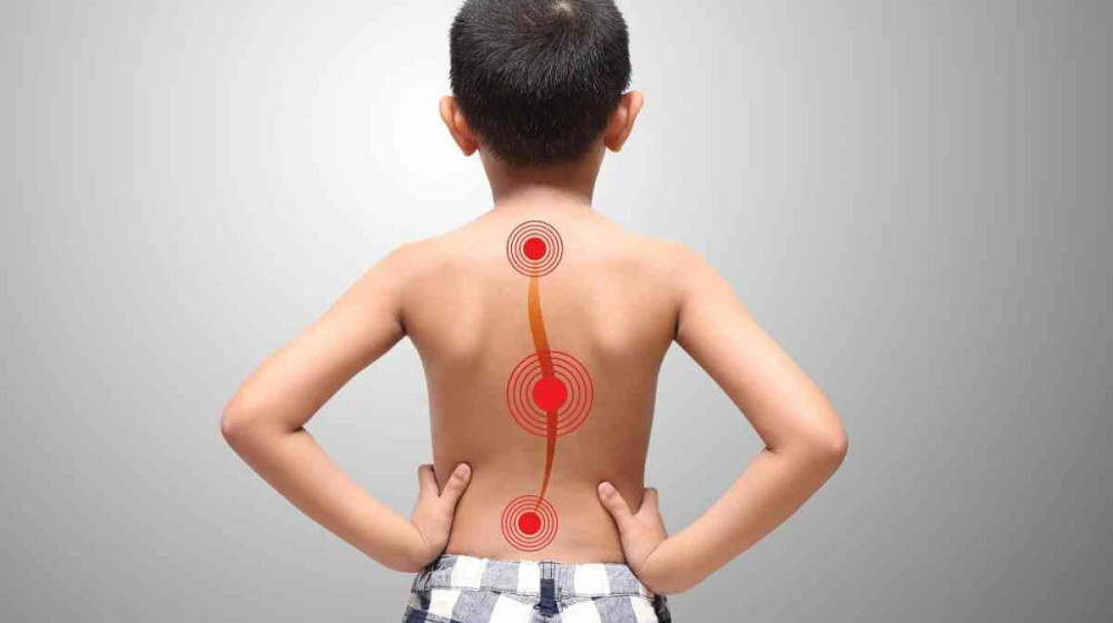    Как распознать сколиоз: простой тест у стены