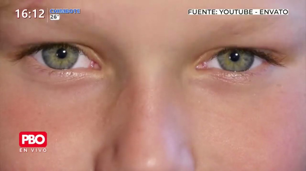    Синяки под глазами у детей: 5 неожиданных причин