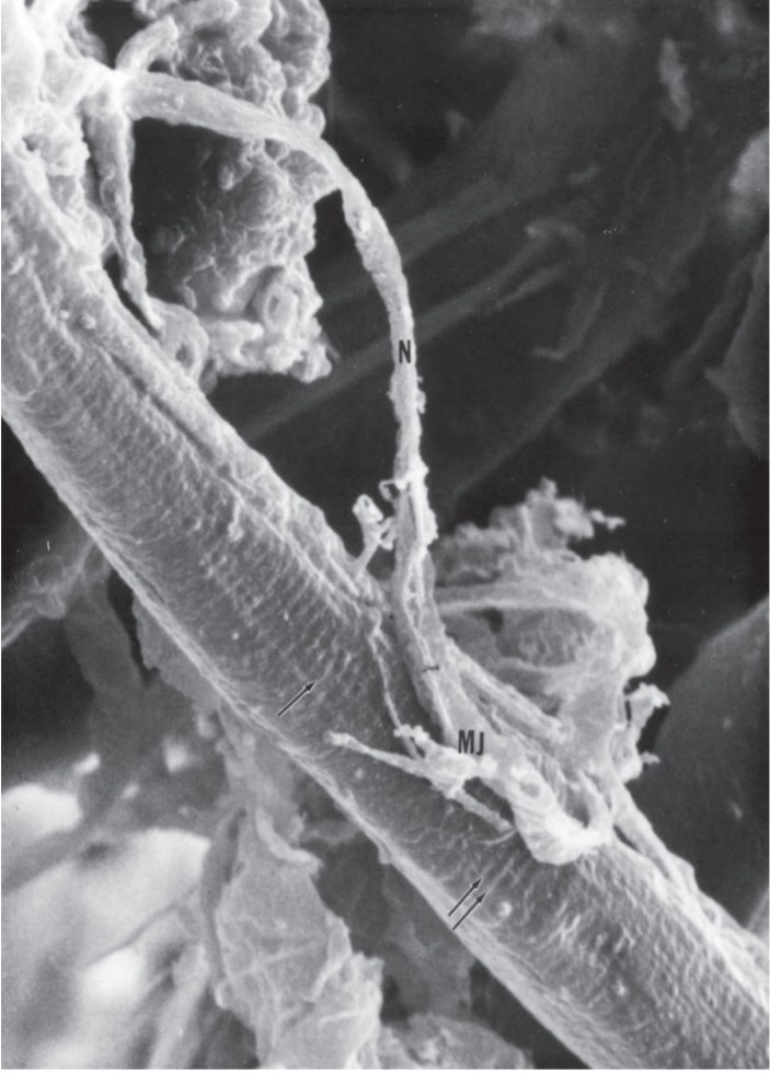 N (neuron) - нейрон. MJ (myoneural junction) - нервно-мышечный синапс. Изображение из Gartner L.P., Hiatt J.L. Color Atlas and Text of Histology, 6th ed.