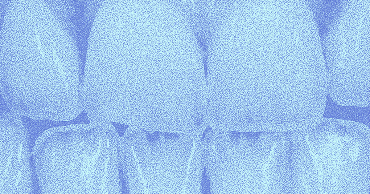    Я только спросить: что такое бруксизм и как перестать скрежетать зубами? (фото 2)