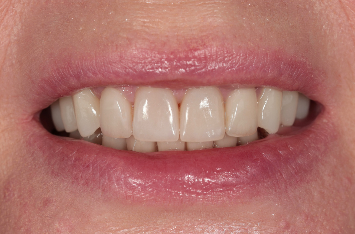 Финишная работа