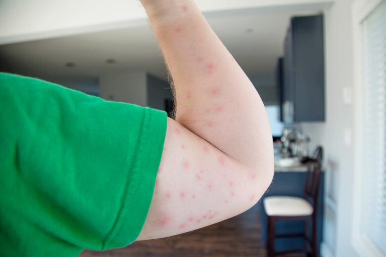    Shutterstock/FOTODOM