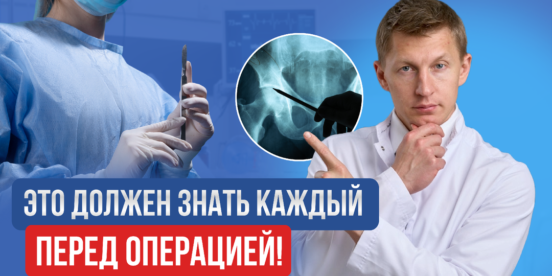 10 вопросов, которые нужно задать врачу до операции на сустав, чтобы не жалеть потом