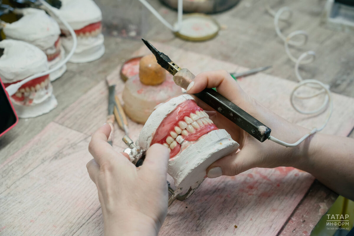 Современная медицина может компенсировать человеку потерянные зубыФото: © Салават Камалетдинов / «Татар-информ»