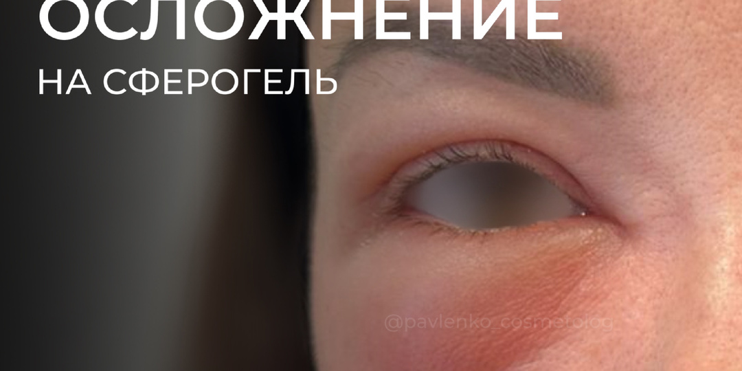 Неудачный поход за красотой: осложнение у косметолога